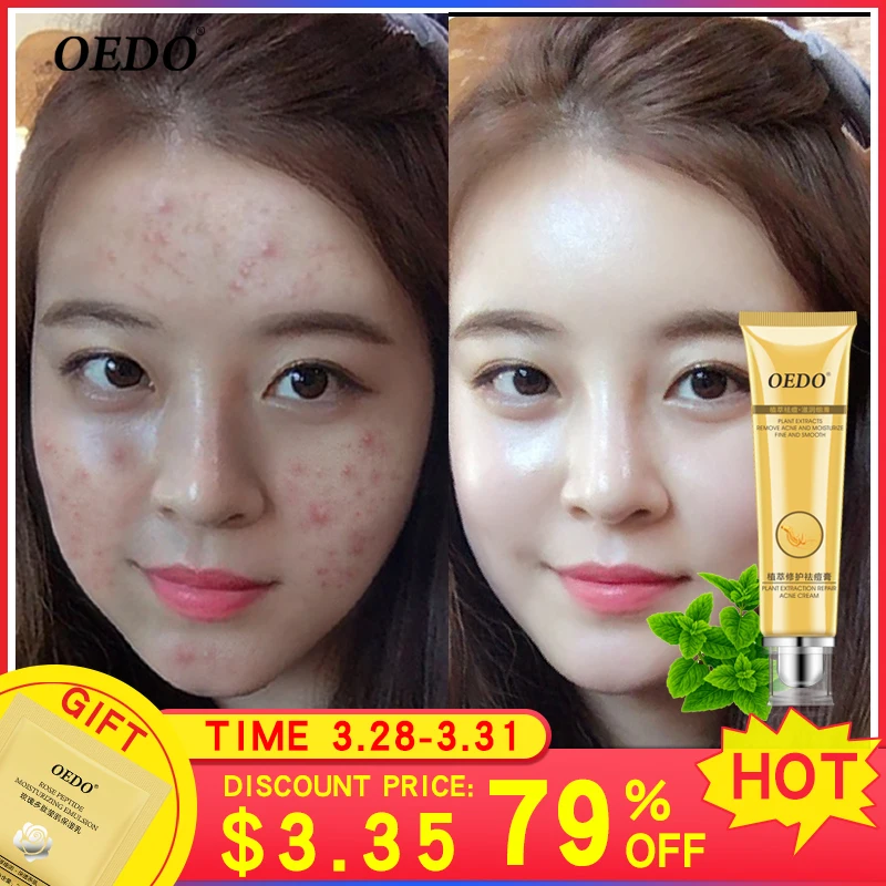 Восстанавливающая и успокаивающая кожу сыворотка с экстрактом ромашки от BREYLEE - косметика