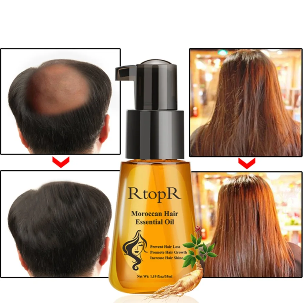 

35ml Prevent Hair Loss Product Hair Growth Essential Oil Easy To Carry Hair Care Nursing Dense Hair Fast Grow For Male Female