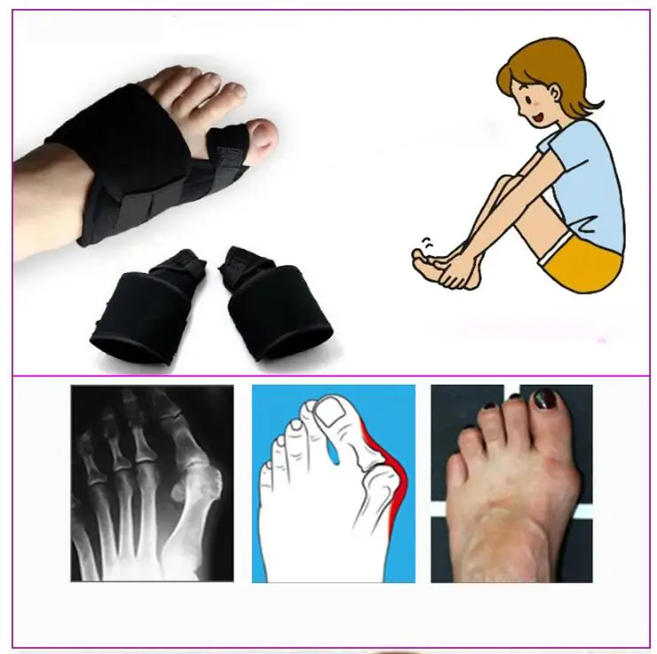 50pcs/25pair Toe Separator Hallux Valgus Corrector Soft Foot Massager Pads Medical Orthopedic Mats Toes Protector Feet Care Tool | Красота и