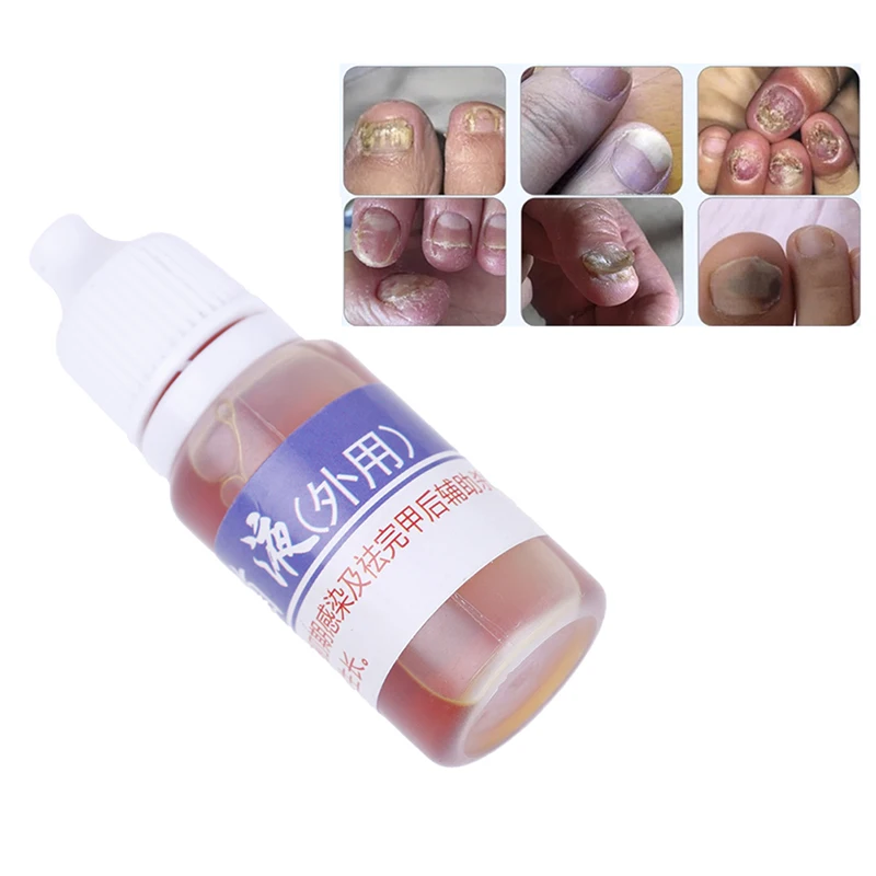 10ml Disinfection Liquid Fungal Nail Treatment Feet Care Essence Foot