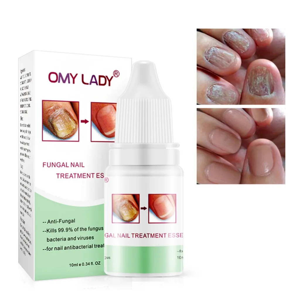 

10ml Nail Repair Liquid Effective Against Nail Fungus Onychomycosis Removal Serum Nail Treatments