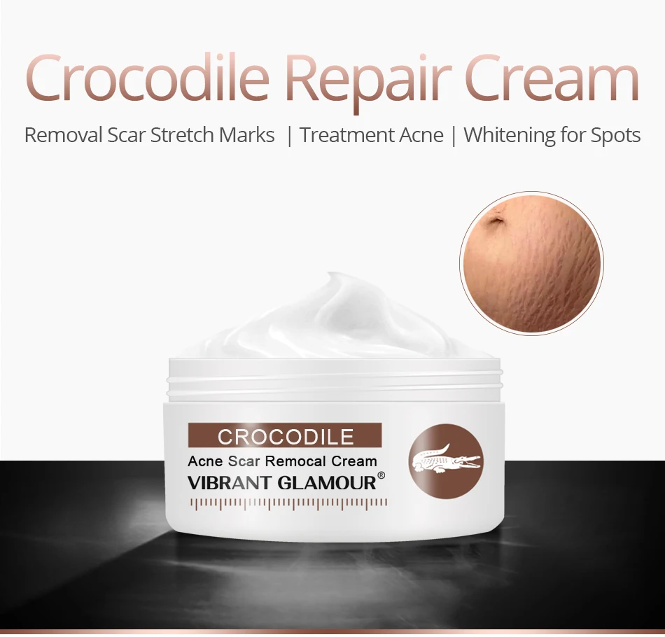 crocodile cream for stretch marks