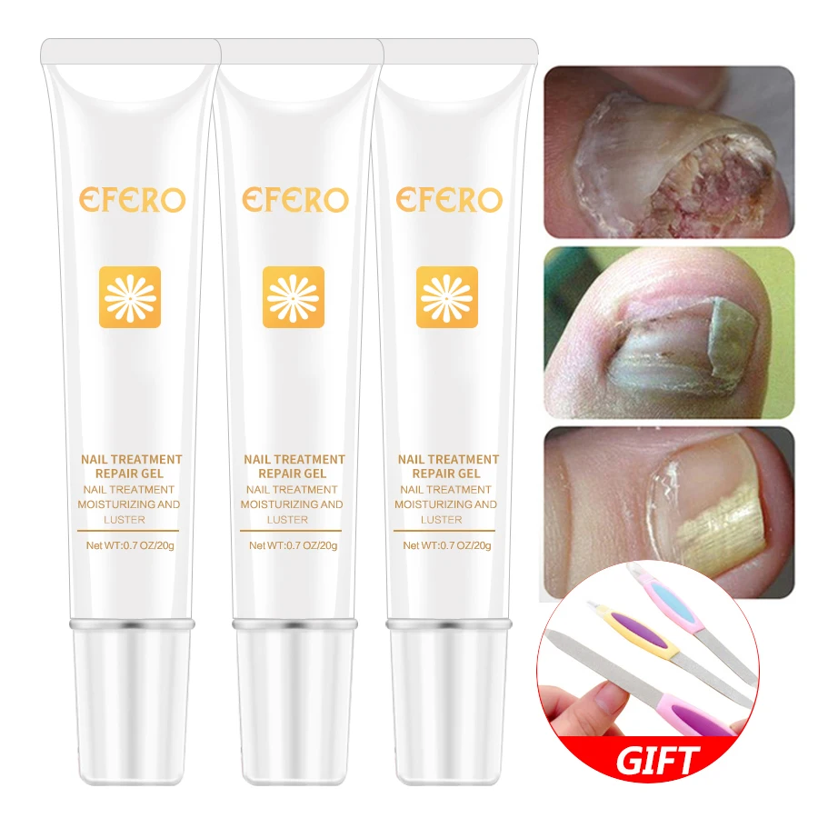 Nail Fungus Treatment Herb Nails Repair Cream Anti Infection Nail Foot