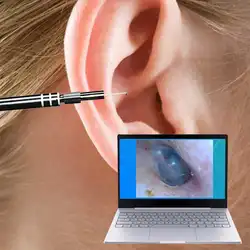 Новый USB уха инструмент для очистки HD Visual инструмент для чистки ушей многофункциональная Ушная палочка с мини Камера ручка Ухо Уход