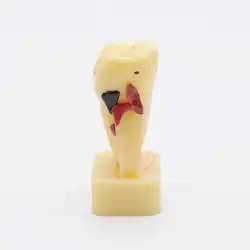 Стоматологии лабораторное оборудование исследование Teach Зуб модель зубы болезни модель