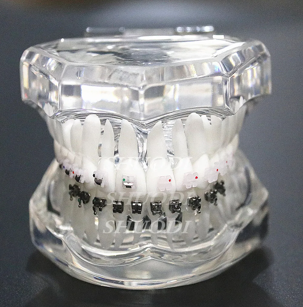 

Dental Orthodontic Model Patients Communication 4 kinds Brackets with Ceramic Self Ligating Bracket Metal Self Ligating