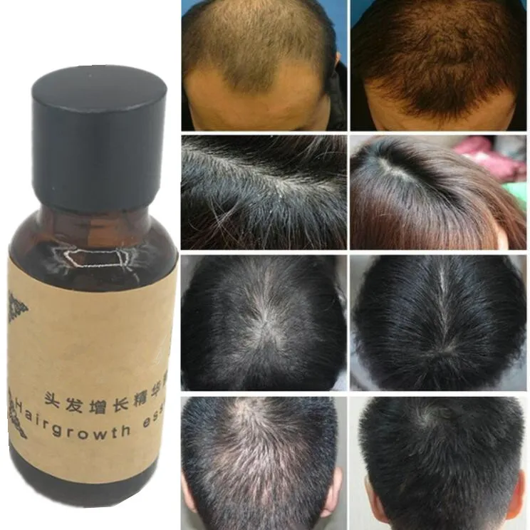 Hair Growth Ginger Oil Natural Plant Essence Hair Tonic Beard Eyelashes Grow Serum for Hair Shampoo Hair Loss Products