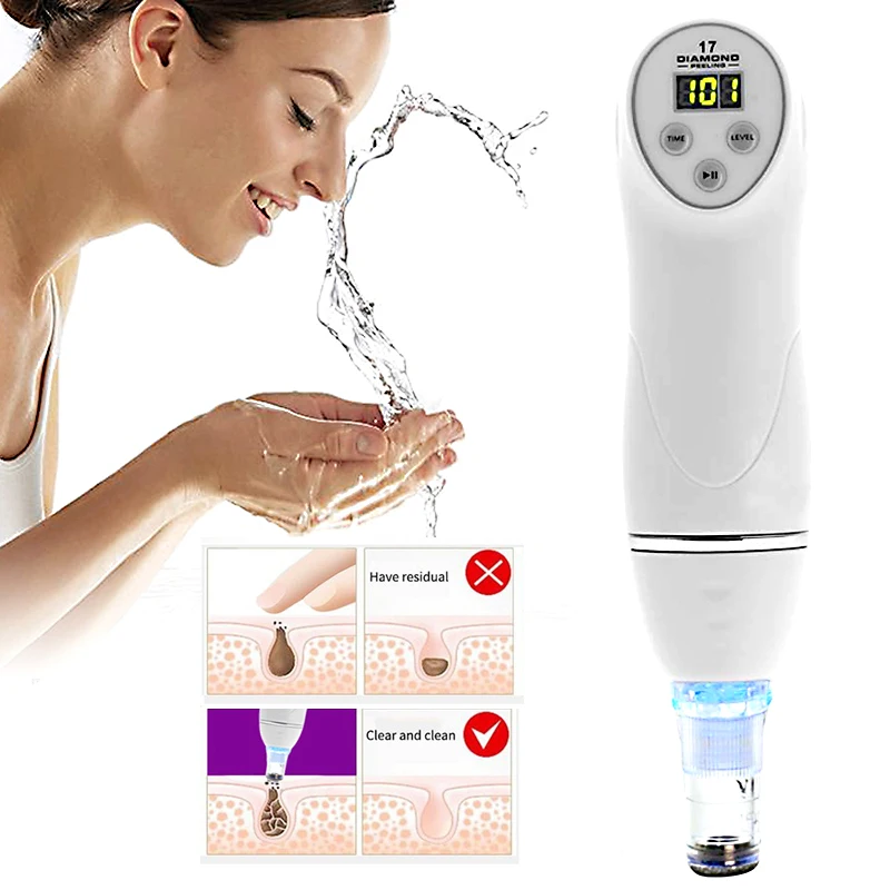 

Face Acne Black Dot Pimple Blackhead Remover Electric Microcrystalline Blackhead Vacuum Cleaner Pore Blackhead Skin Care Machine