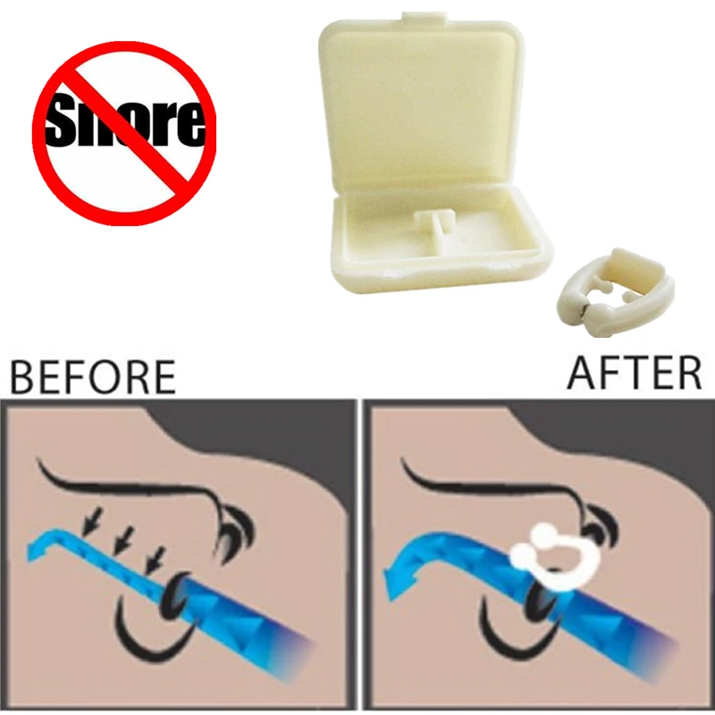 snore killer