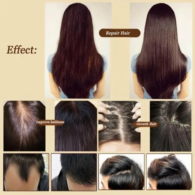 30 мл имбирное органическое эфирное масло для роста волос продукты для выпадения волос уход за волосами ингибитор масло сыворотка повреждения питание волос
