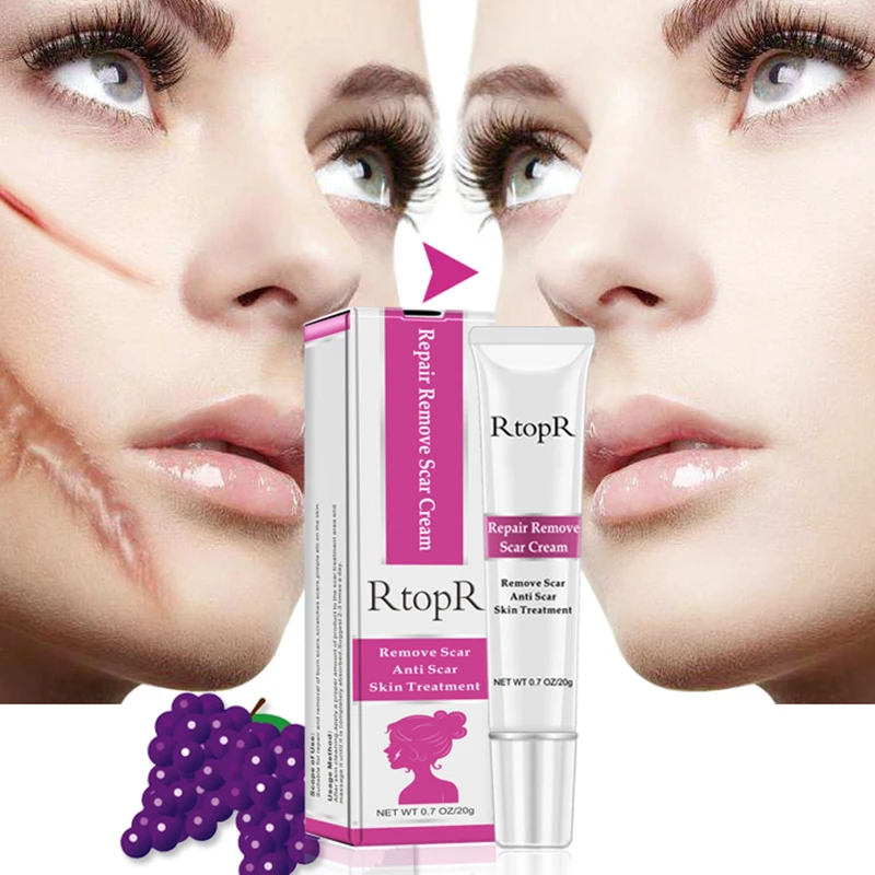 Strong Effects Powerful Stretch Marks Remove Acne Scar Treatment Cream