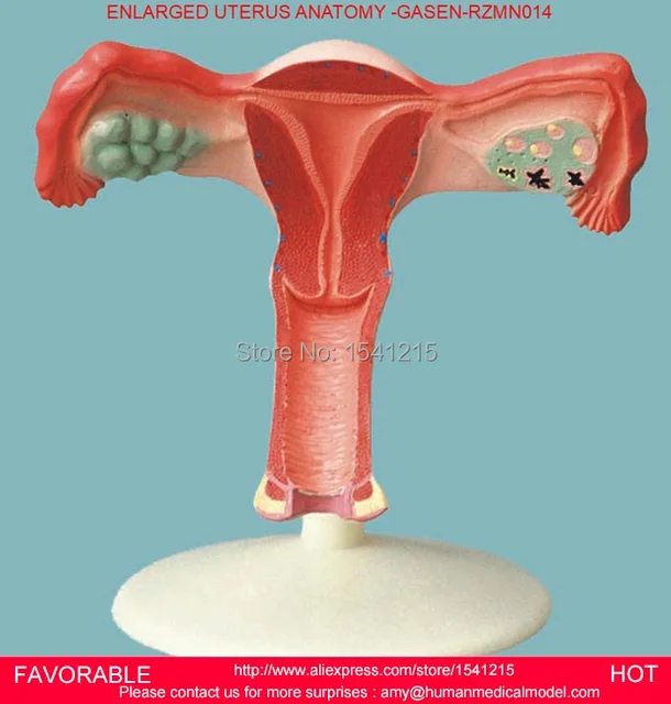 MODEL OF THE UTERUS,GENITAL ANATOMY MODEL,FAMILY PLANNING TEACHING