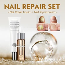 Яркий гламурный набор для ухода за ногтями крем для ремонта ногтей противогрибковый восстанавливающая сыворотка для ногтей Лечение грибка онихомикоза удаление