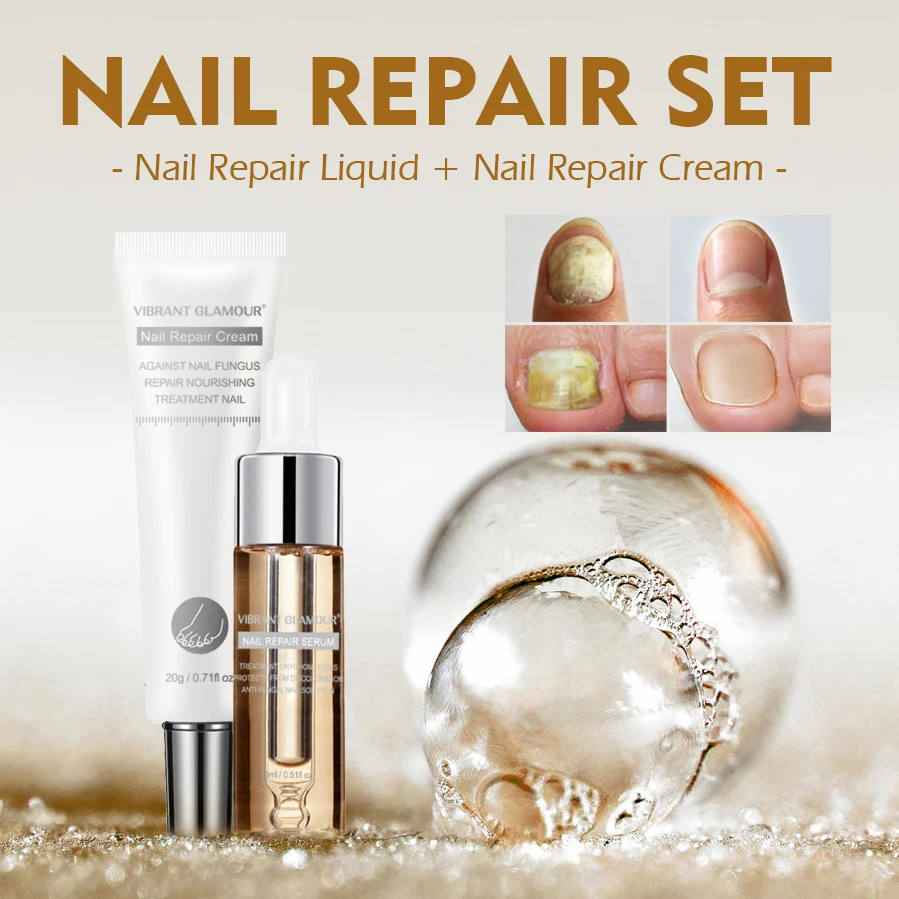 

VIBRANT GLAMOUR Nail Care Set Nail Repair Cream Anti Fungus Nail Toe Repair Serum Nail Fungus Treatment Onychomycosis Removal