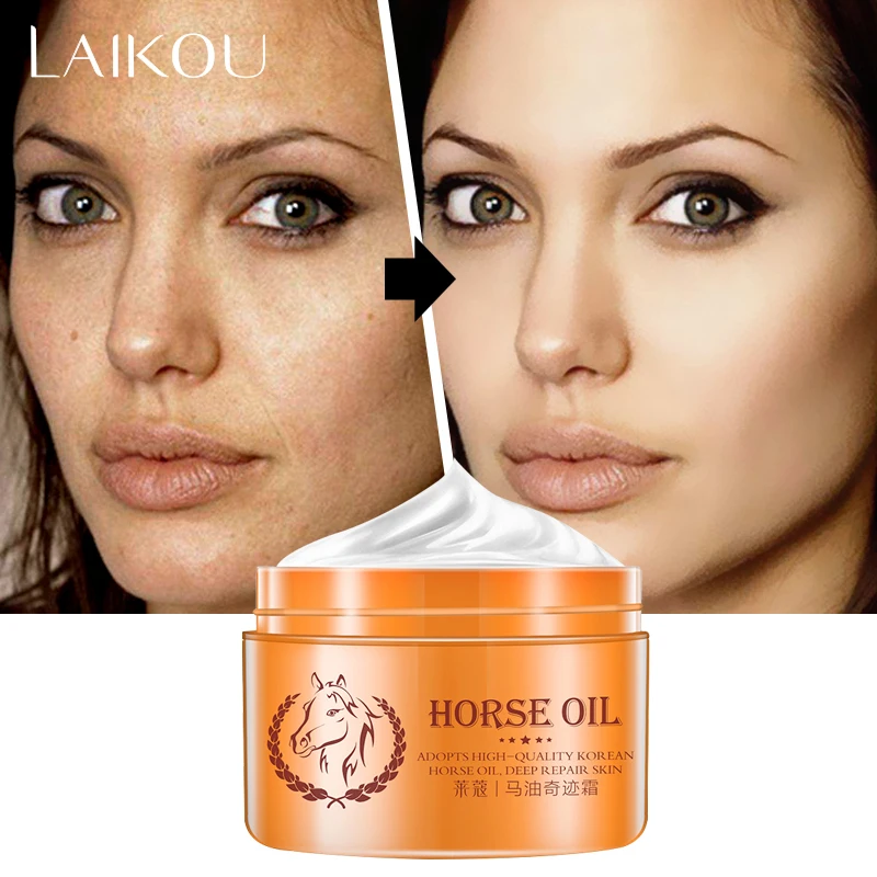LAIKOU Face Moisturizers, Moisturizing Cream For Oily Skin Anti Freckle