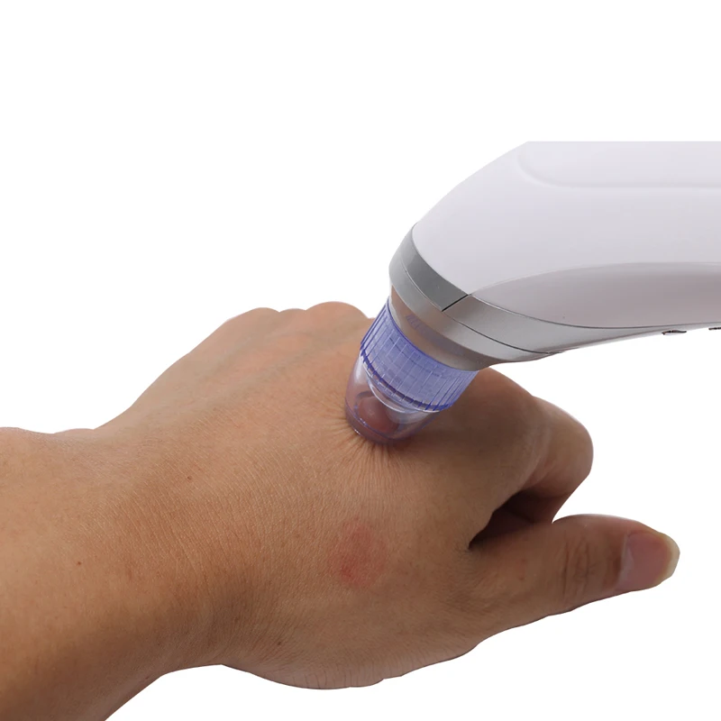 Vacuum-Blackhead-Remover-Vacuum-Pore-Cleaner-Suction-Beauty-Machine-Diamond-Dermabrasion-Remove-Face-Blackhead-Pore-Cleaning (4)