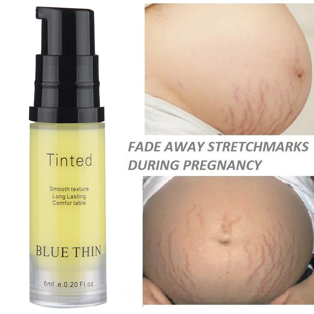 6ML Striae Repair Cream Removal Scar Stretch Marks Cream Fat Scar Striae Gravidarum Treatment