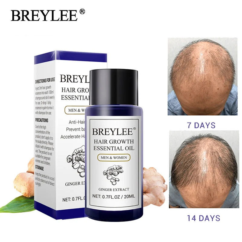 

BREYLEE Hair Growth Essential Oil 20ml Fast Powerful Hair Products Hair Care Prevent Baldness Anti-Hair Loss Serum Nourishing