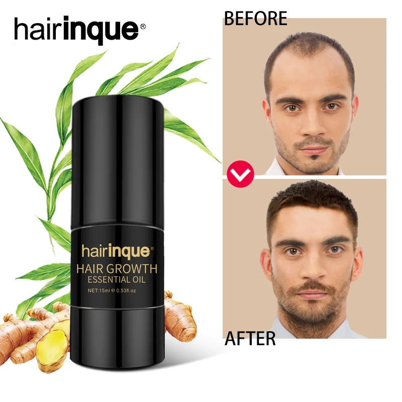 Hairinque лидер продаж 15 мл экстракт имбиря эссенция для роста волос лечение