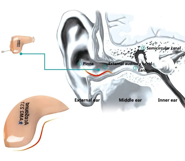 AcoSound уход за ушами, невидимые Цифровые слуховые аппараты CIC 610IF, мини-усилитель звука в ухо, программируемые слуховые аппараты, слуховое устройство