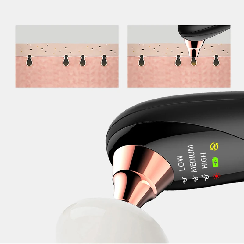 Limpeza dos Poros Sucção de Vácuo Removedor de Cravo Rosto Cravo Nariz Blackhead Remover Acne Pimple Ponto Preto Mais Limpo Vácuo 17 Beleza e saúde