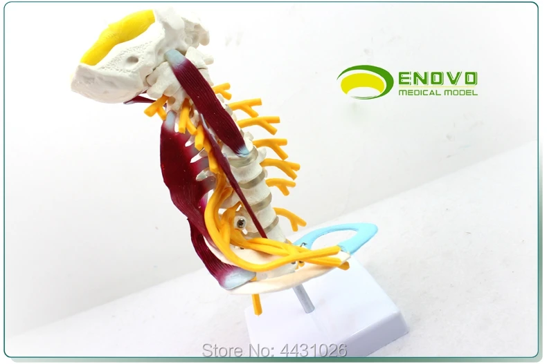 Эново модель человеческого костного образца в плечевом сплетении мышечной модели человеческого шейного отдела позвоночника