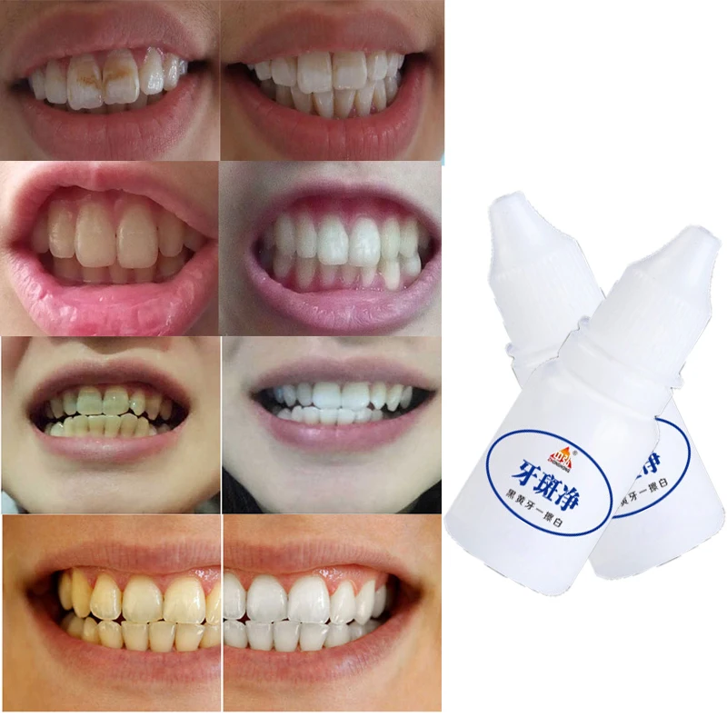

10ml Teeth Whitening Clean Tooth Teeth Whitening Water Dental Charcoal Teeth Whitening Plaque Remover whitening Odontologia Tool