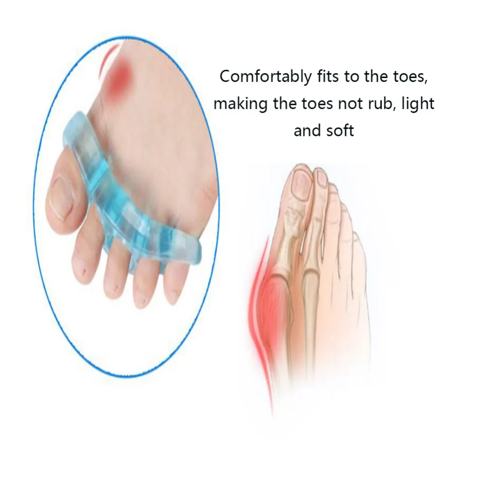 Петли Toe Сепараторы Распорки гель увеличения пространства для правильного выравнивания правильный перекрытия молоток носком