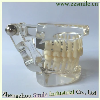 

Clear Mixed Dentition-Age 3 years Old(CompleteTransparent)