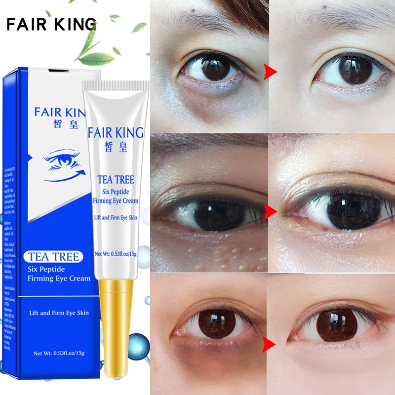 cream to lighten under eyes