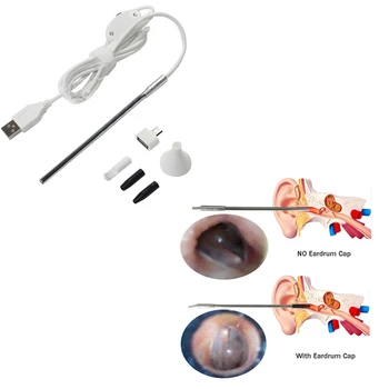 

Medical USB Endoscope with 4.9mm Lens Borescope For Android Phone PC Inspection Otoscope Endoscope Camera For Ear Nose Tool 30