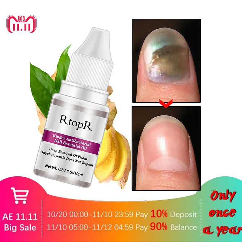 Nail and Foot Hand Care Whitening Toe Nail Anti Fungus