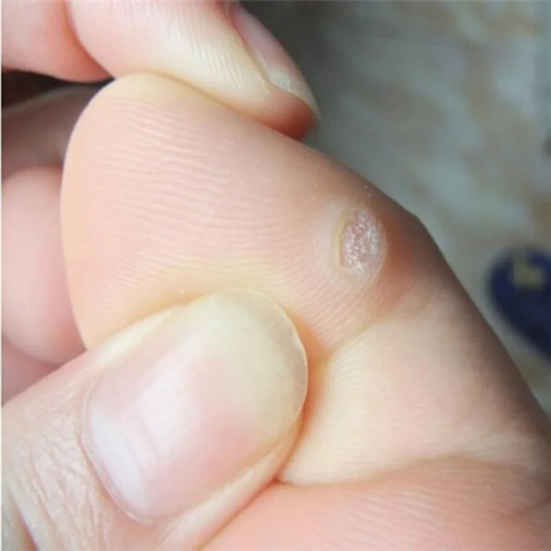 B (5)