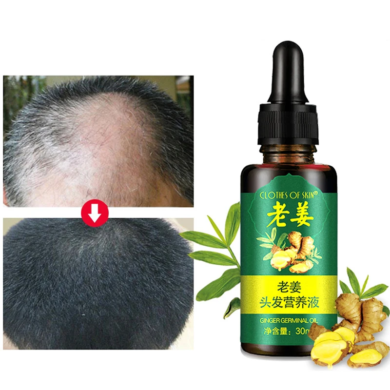 30ml Anti Hair Loss Liquid Ginger Hair Growth Serum Essence for Women and Men Damaged Hair Repair Growing Faster Repair UZ85