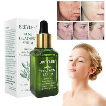 

1Pc Green Tea Essence Acne Treatment Serum Facial Anti Acne Scar Removal Skin Care Whitening Pimple Remover Repair Liquid TSLM1