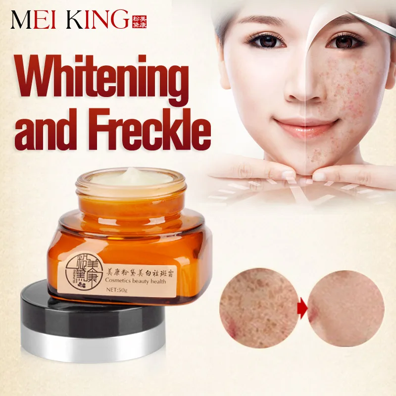 cream to remove freckles from face
