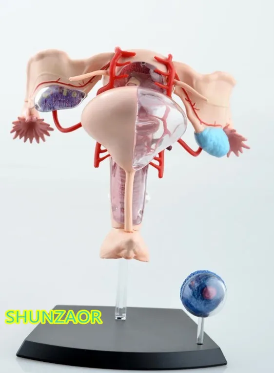 4D 1