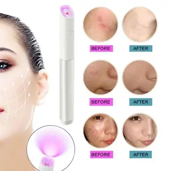 

1pc Useful Acne Scar Removal Pen Blue/Red Light Machine For Anti-Inflammation Scar Removal Treatment Skin Tightening