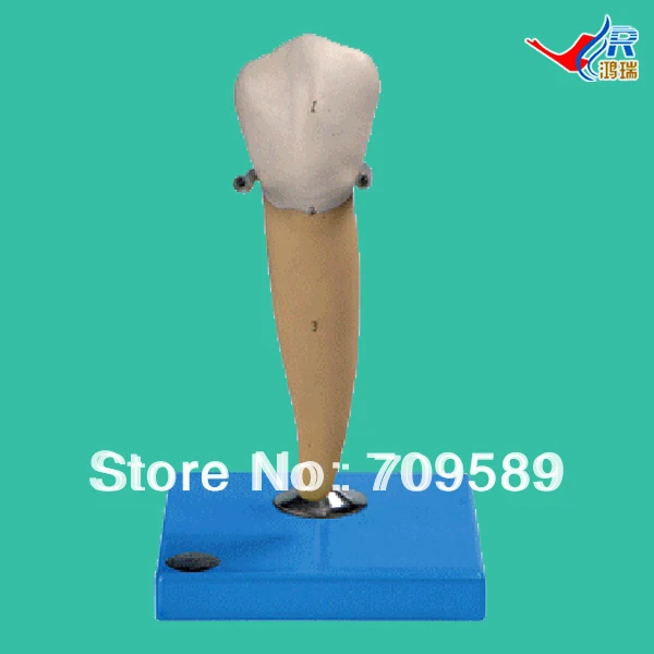

Lower Molar with One Root Model, Molar Teeth Model