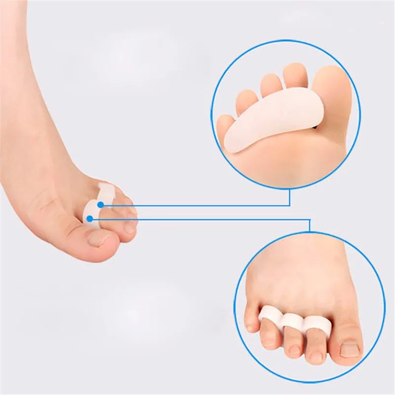 1 пара Силиконовый гель Bunion Splint разделитель носка Перекрывающийся