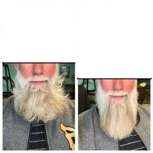 before after