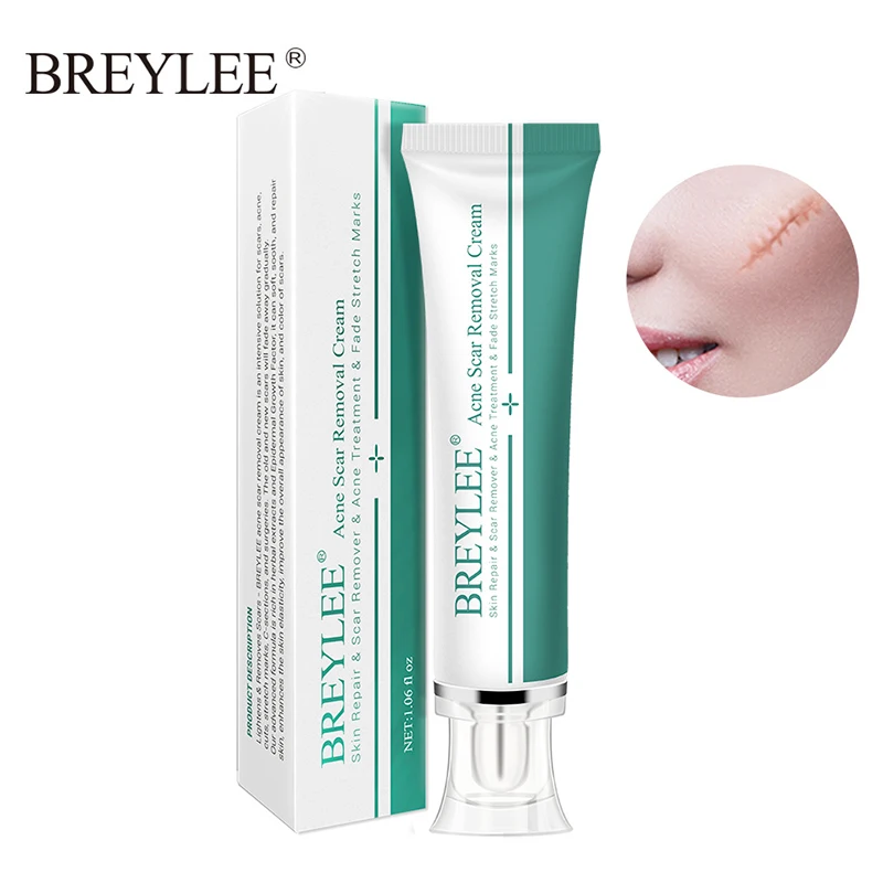 

Acne Scar Removal Cream 30g Face Acne Treatment Cream Remove Stretch Markings Repair Scar Whitening massage Cream JLRS18
