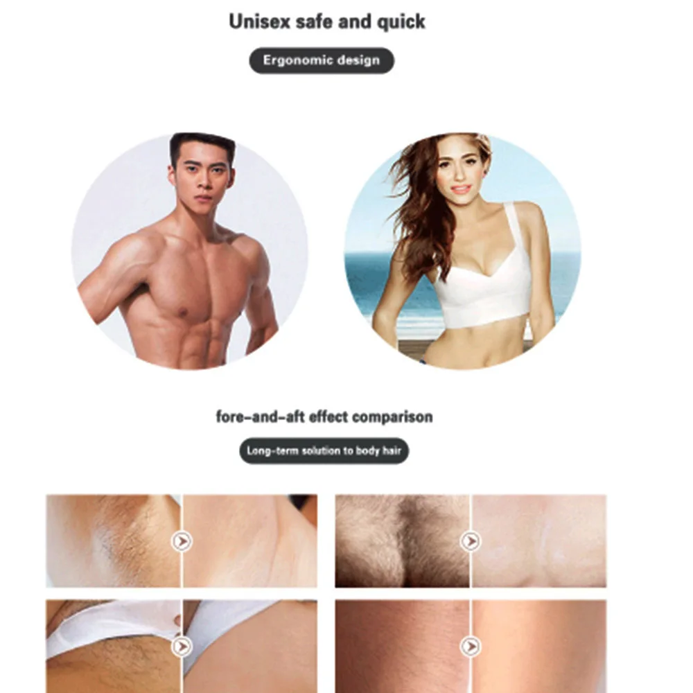 

Laser Epilator Hair Removal Machine Hair Removal Permanent Bikini Home Electric Depilador