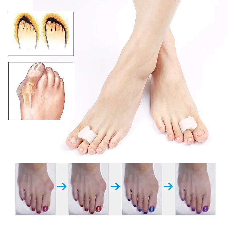 1Pair Braces Foot Care Toe Braces Silicone Toe Separator Hallux Valgus Orthopedic Corrector Pedicure Tools Health Care Products