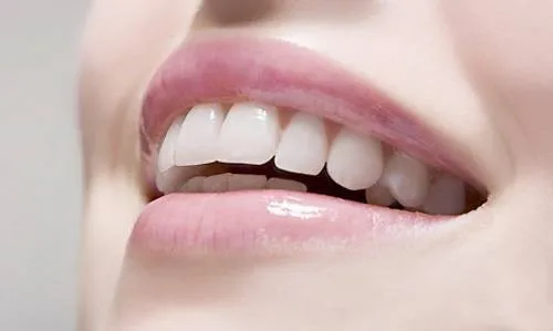 10 шт. супер сильная ручка для отбеливания зубов 44% CP|smile fridge|kit figurekit circuit |