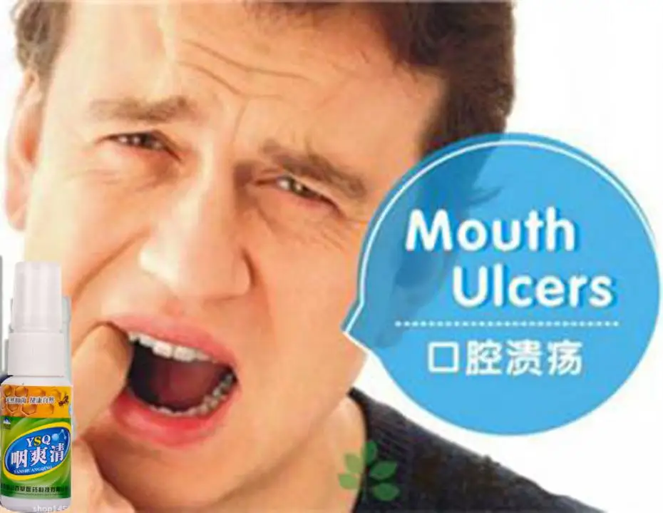antibacterial-Oral-Spray-Hygiene-Oral-Care-Fresh-Mouth-Fresh-Breath-Cure-Mouth-Ulcers-Clean-Mouth (2)