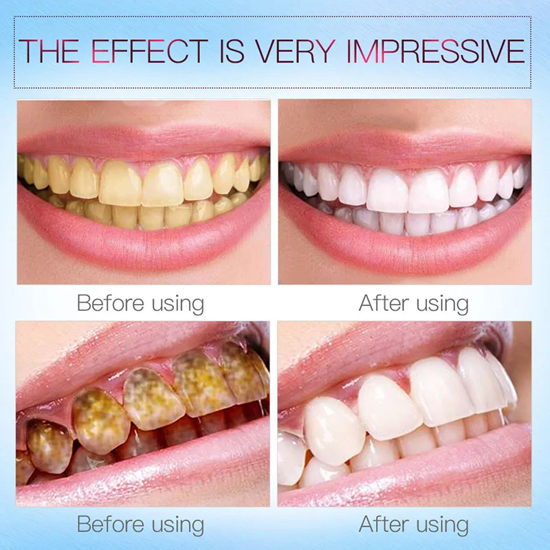 

Effective Teeth Whitening Pen Tooth Whitener Tea Coffee Stain Remove Teeth Care SSwell