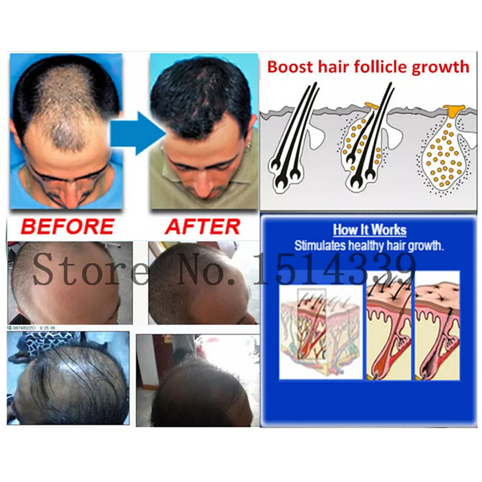 

2 Pcs Herbal fast hair growth Alopecia anti baldness hair loss spray 7 days Healthy DNA liquid hair regrowth treatment products