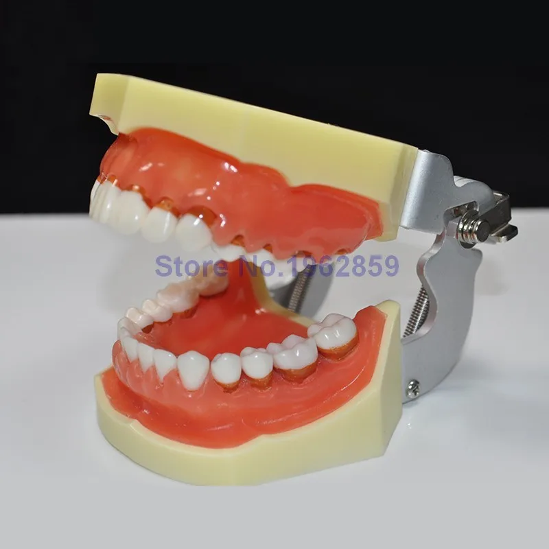 

Teeth Model Dental Periodontal Disease Practice Dental Model With Removable Gum Can
