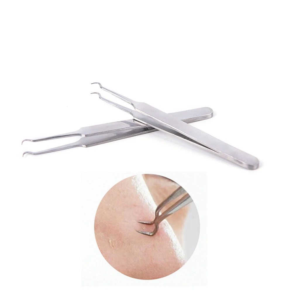 Пинцет для ухода за кожей лица 8 см 1 шт.|tweezers remover|blackhead tweezertweezers eyelash extension |